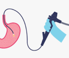 Endoscope-Flexible