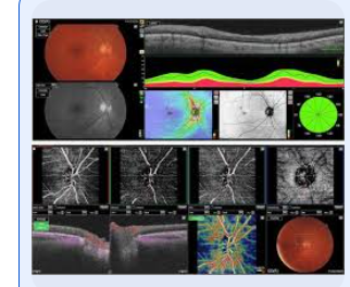 ImageNet, Topcon 2c