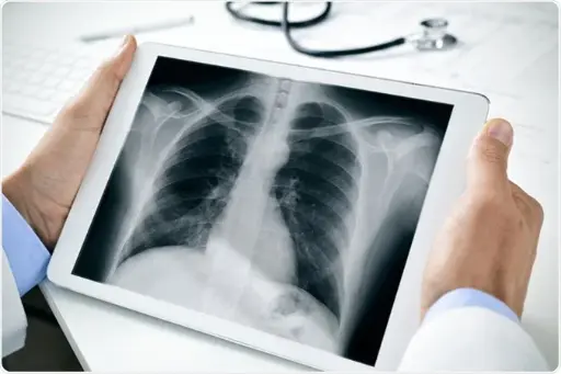 Introduction to Digital Radiography